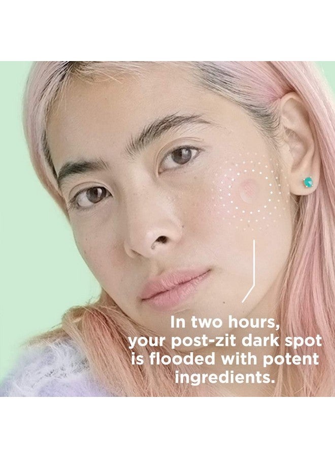 ZITSTICKA Hyperfade Microdart Acne Patch For Face 4 Pack Patches To Fade Postzit Dark Spot Deep Blemish & Early Stage Pimple Lighten & Brighten Skin Treatment - Image 3