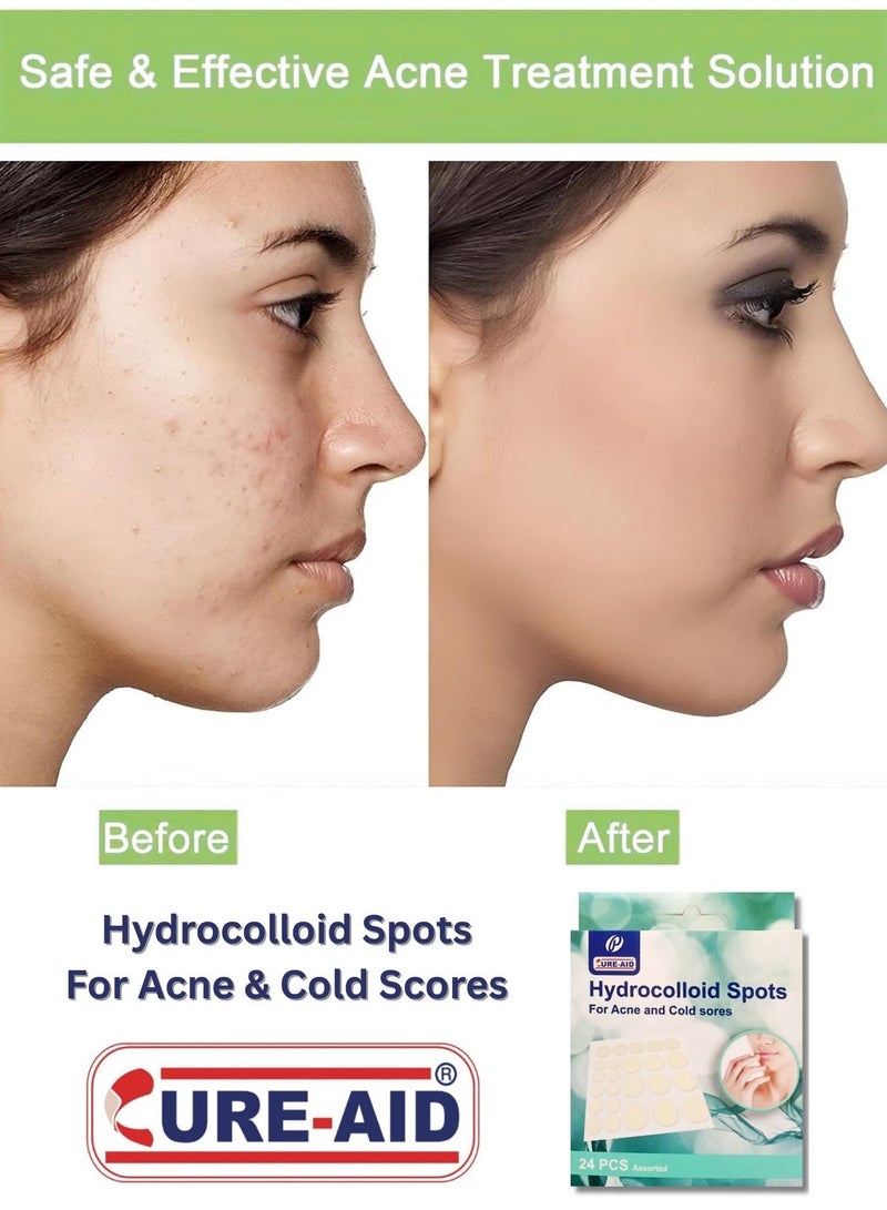 كيور إيد بلاستر لتغطية حبوب الشباب شفاف 24 قطعة - Image 5