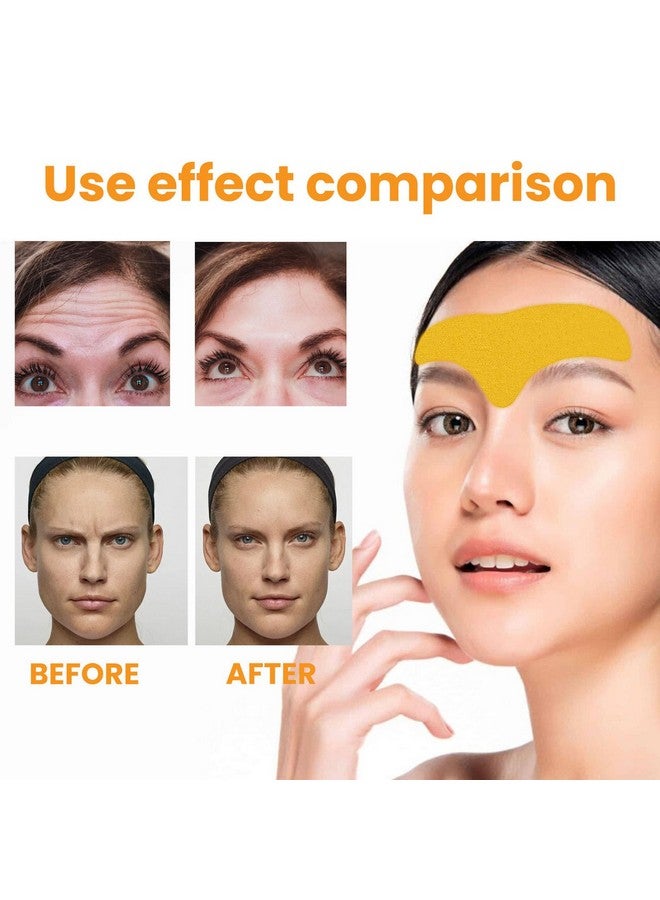 Grospe Forehead Wrinkle Remover Patchsmooth Forehead And Smooth Fine Lines And Wrinkleslift Facial Skin Forehead Patchforehead Patches For Wrinkles With Hydrolyzed Collagen And Centella Asiaticasuitable - Image 4