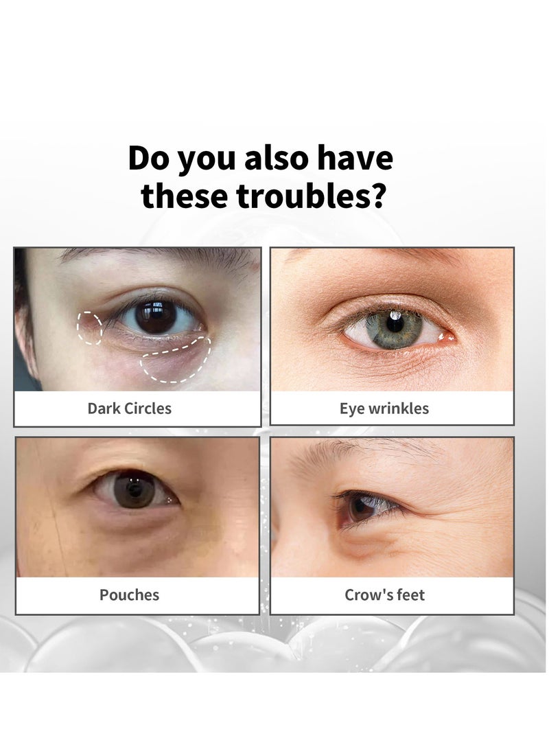 Instant Firm Eye Tightener, Eye Firming Cream, Instant Under Eye Tightener, For Puffiness And Bags Under Eyes, Naturally Eliminate Wrinkles, Puffiness, Dark Circle and Bags 30ml