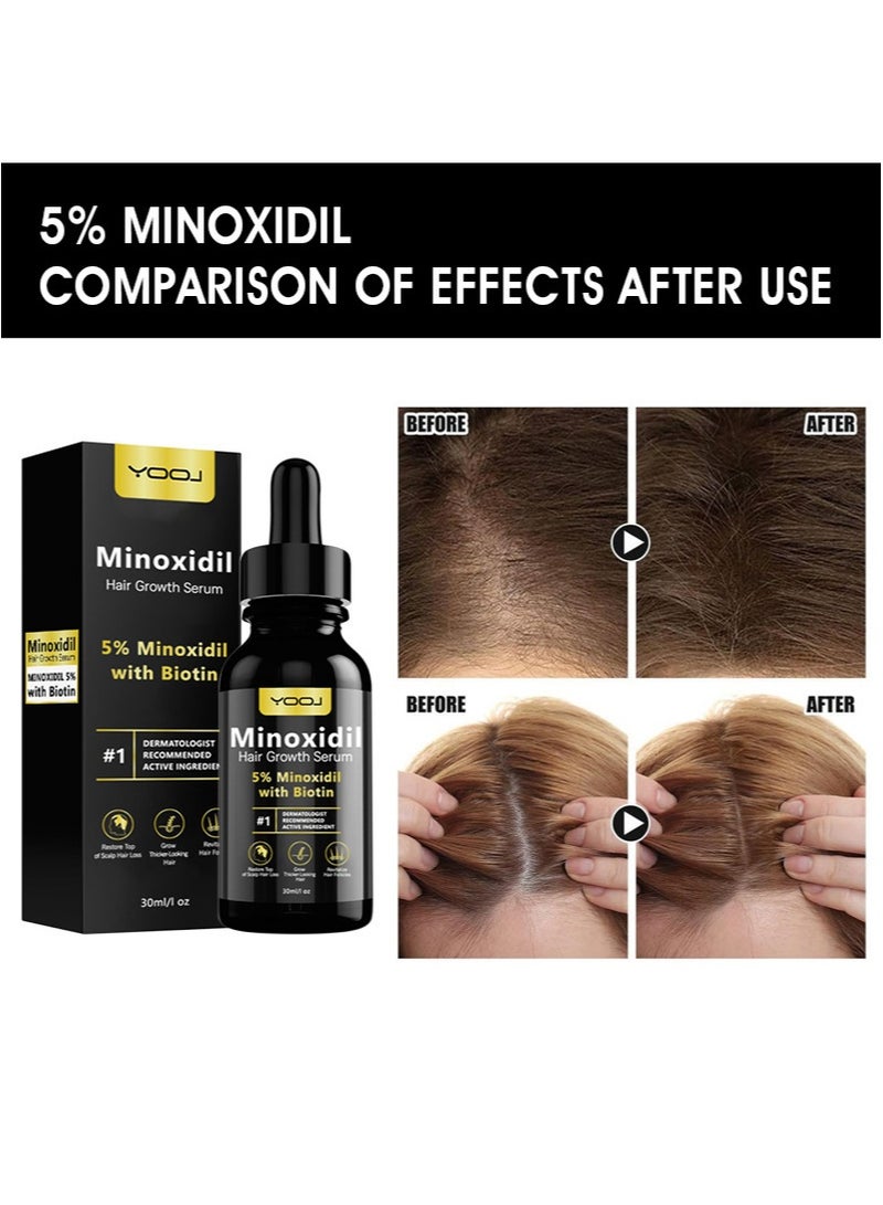 يوج 5% Minoxidil Hair Growth Serum for Men and Women - Infused with Biotin, Niacinamide and Castor Oil - Minoxidil for Men Beard Growth - Anti Hair Loss Treatment for Stronger and Longer Hair-1 Fl Oz - Image 2