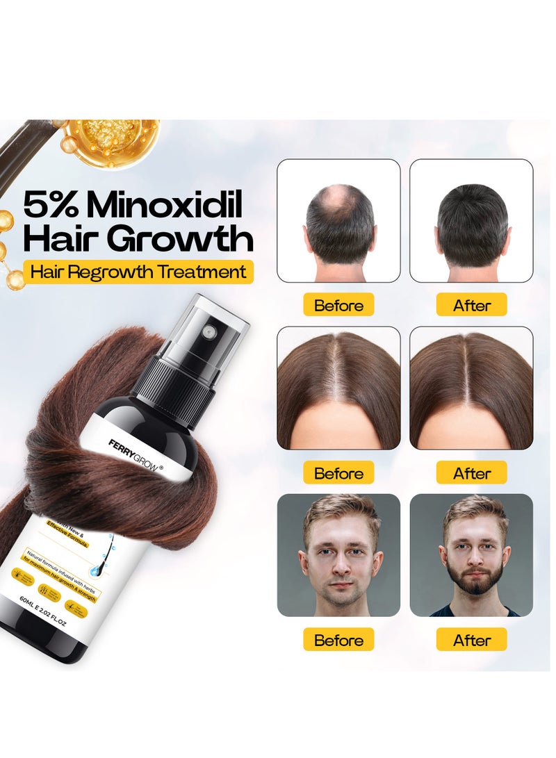 فيري جرو سيروم فيري جرو لنمو الشعر، مينوكسيديل ٥٪ مع البيوتين - علاج لإعادة نمو الشعر للرجال والنساء - يقلل من تساقط الشعر، ويحفز نموه، ويقوي جذوره - ٦٠ مل - Image 3