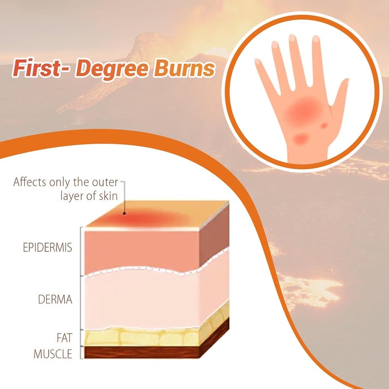 MedEduQuest Burn Wound Packing Trainer Burn Moulage Adhesive Skin Burn Wound Trainer for Wound Care Training First Degree Burn Wound Training Model - Image 4