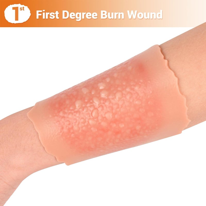 MedEduQuest Burn Wound Packing Trainer Burn Moulage Adhesive Skin Burn Wound Trainer for Wound Care Training First Degree Burn Wound Training Model - Image 3