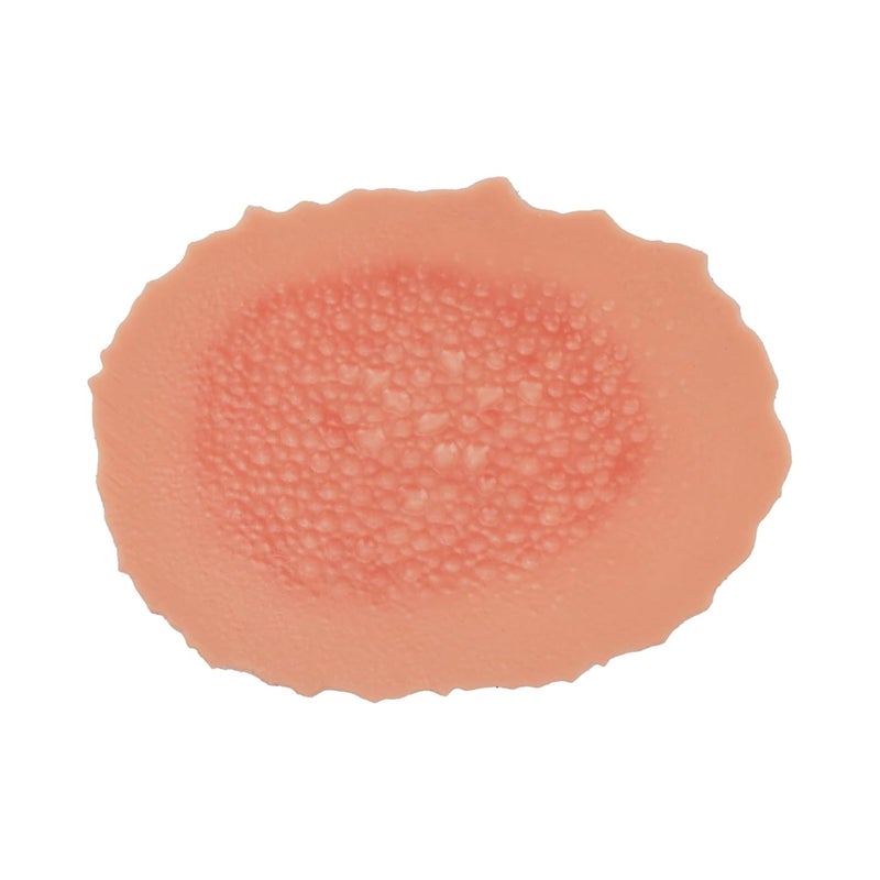 MedEduQuest Burn Wound Packing Trainer Burn Moulage Adhesive Skin Burn Wound Trainer for Wound Care Training First Degree Burn Wound Training Model - Image 1