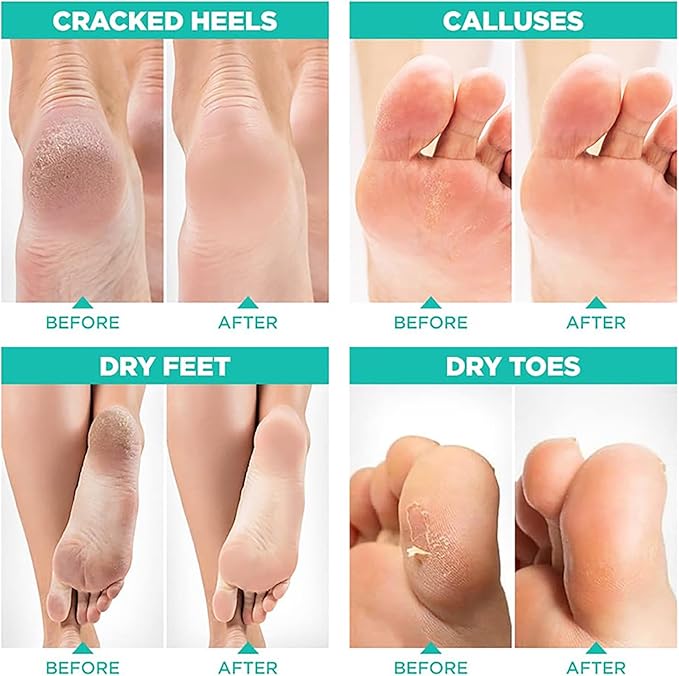 Joyeee Foot Peel Mask for Hard Skin 4 Pairs Exfoliating Foot Peeling Mask Foot Peel Socks for Removes Calluses and Hard Skin Foot Care For Men and Women