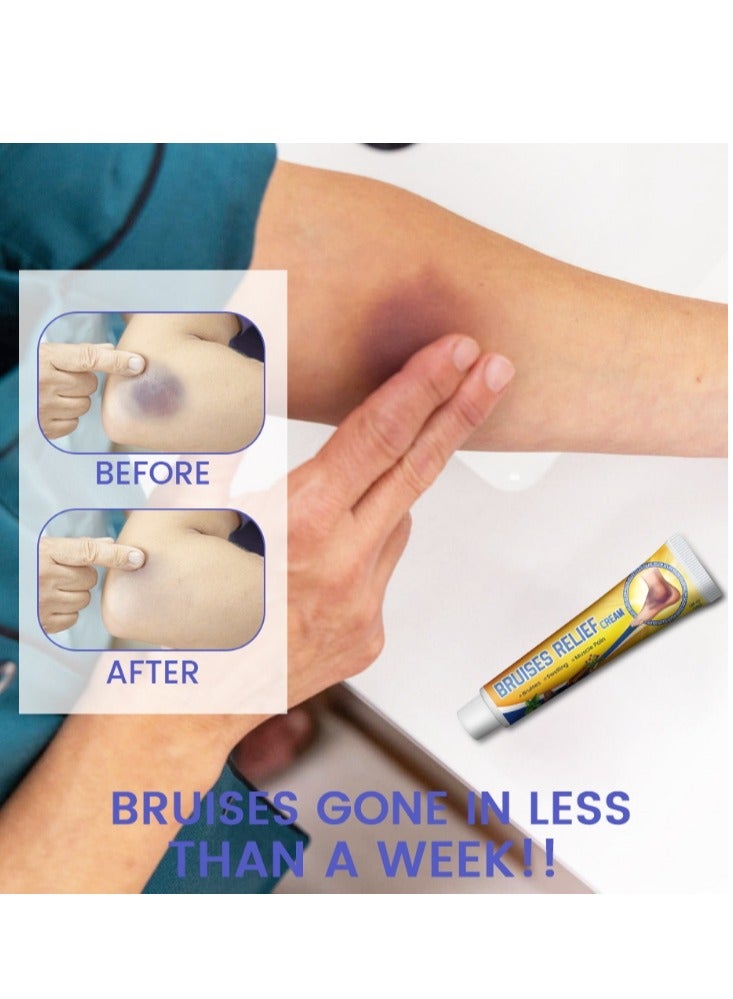 سوميفون كريم تخفيف الكدمات، كريم اللياقة البدنية والإصابات، 1 قطعة 30 جم - Image 2