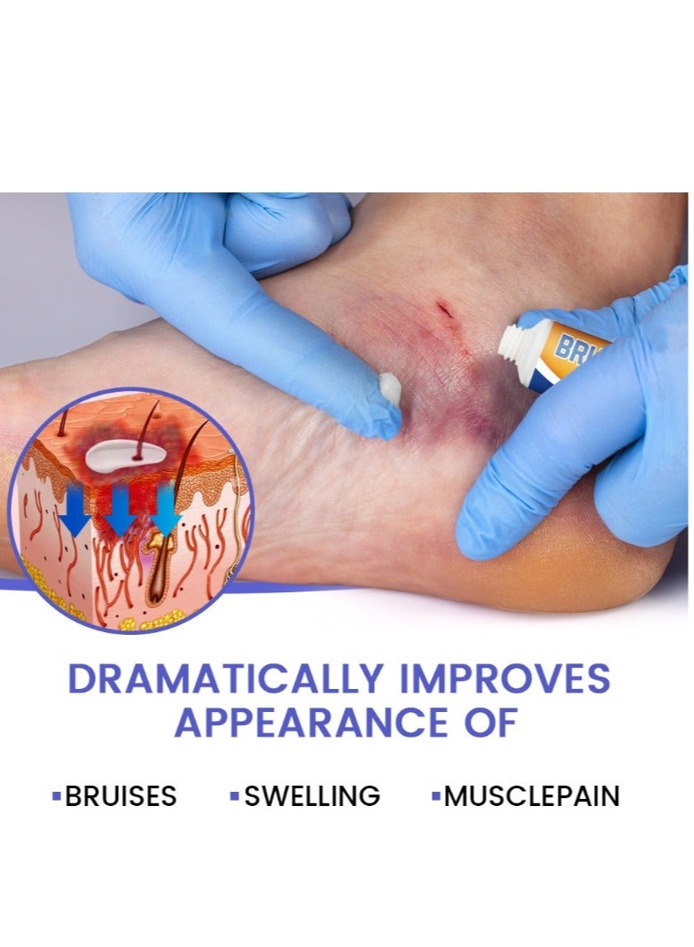 سوميفون كريم تخفيف الكدمات، كريم اللياقة البدنية والإصابات، 1 قطعة 30 جم - Image 3