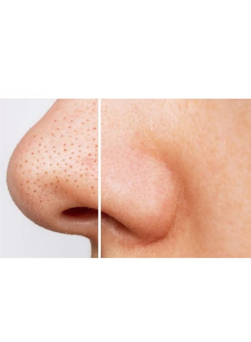 سي-توا شرائط تنظيف الأنف (3 شرائط) بنكهة الفراولة. - Image 2