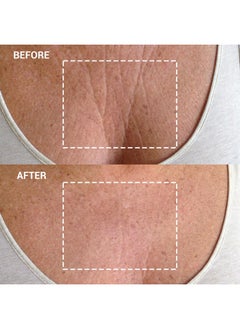 WRINKLES SCHMINKLES Wrinkles Schminkles Chest Wrinkle Patch - Reusable Silicone Smoothing Pads for Cleavage & Body, Reduce Wrinkles & Stretch Marks, Sensitive Formulated, Secret to Radiant Skin (1 Pack)  - Image 3