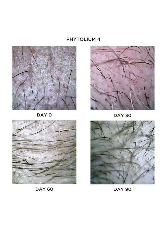 PHYTO Phytolium 4 Botanical Densifying Scalp Treatment, 12 flasks - pzsku/Z8D18AE3FF4637E4CB2BDZ/45/_/1741330031/bb4a0374-ab54-4ce2-9687-328206404858