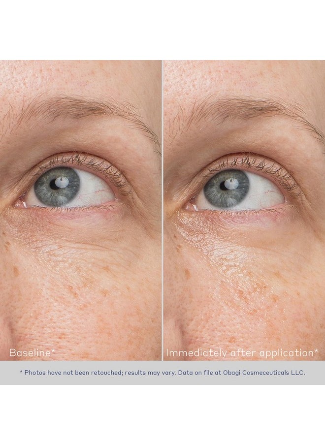 Obagi Medical Obagi Daily Hydrodrops Rejuvenating Eye Gel Cream Reduces The Appearance Of Dark Circles & Instantly Brightens Smooths & Depuffs Eyes 0.5 Oz  - Image 5