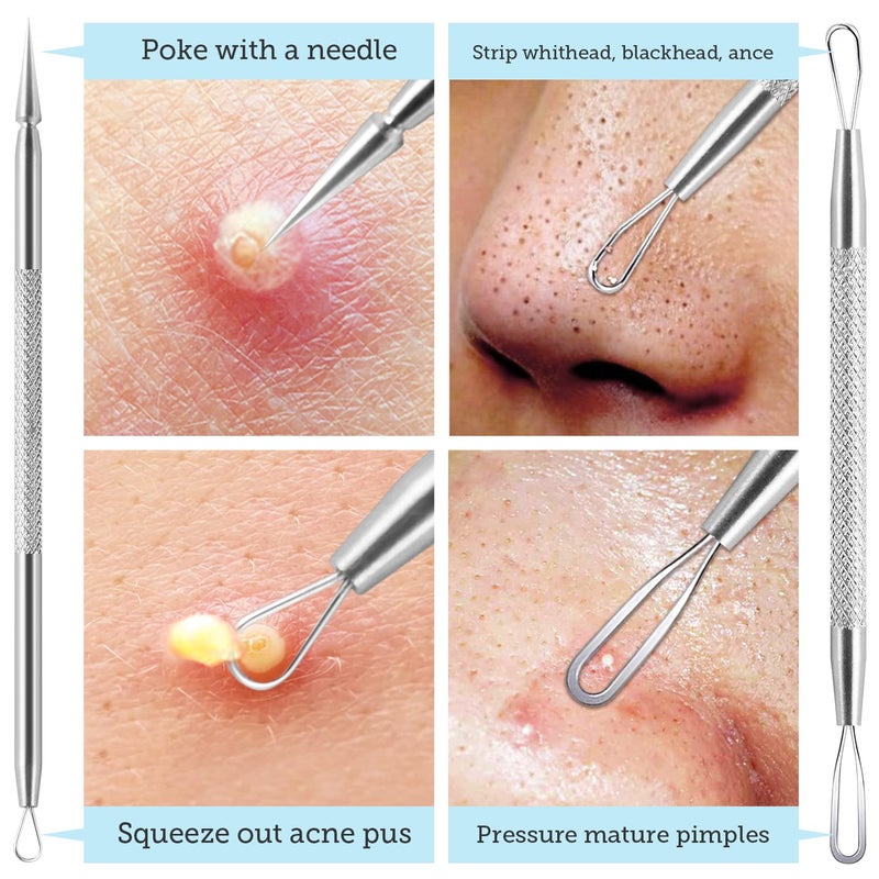 LitBear Pore Prep Tool, Blackhead Remover Pimple Popper Tool Kit, Stainless Steel Blackhead Extractions Tool for Acne, Whitehead Popping, Blemish, Comedone, Black - Image 5