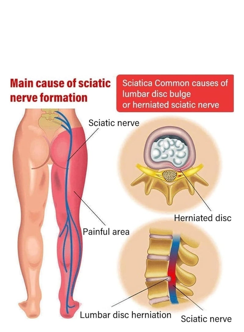 EELHOE 2 PCS Knee Pain Relief Spray - Lumbar Spine Cold Gel Spray, Knee Joint Pain Relief Supplements, Herbs Bruise Spray, Arthritis Pain Relief, Relief Muscle Cramp，Natural Pain Reliever Spray - Image 4