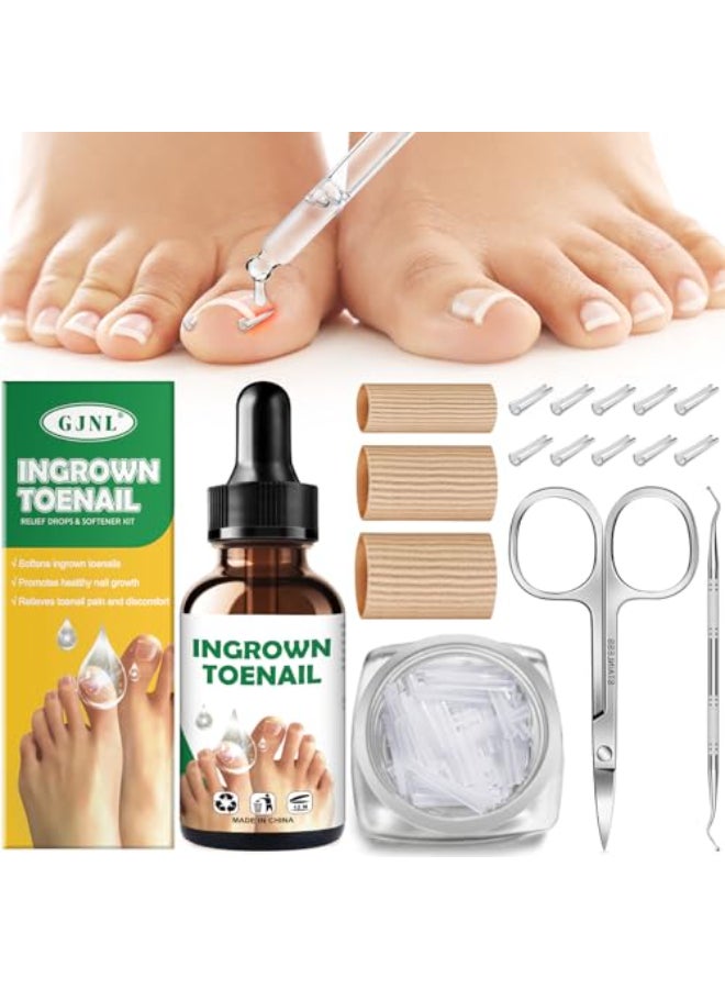 GJNL Ingrown Toenail Kit Ingrown Toenail Drops Ingrown Toenail Set 60 Pcs Toenail Straightener Strips Toenail Lifter Small Scissors - Image 1