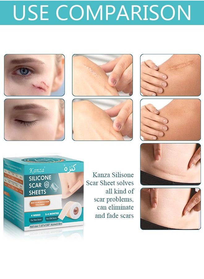 Kanza Medical Grade Silicone Scar Sheets Roll 3.8m Tape Keloid C-Section Surgical Scars Removal Treatment Silicon Gel Cream Patch Bandage Removes Abs Tuck Surgery Scars (4cm x 3.8m)  - Image 2