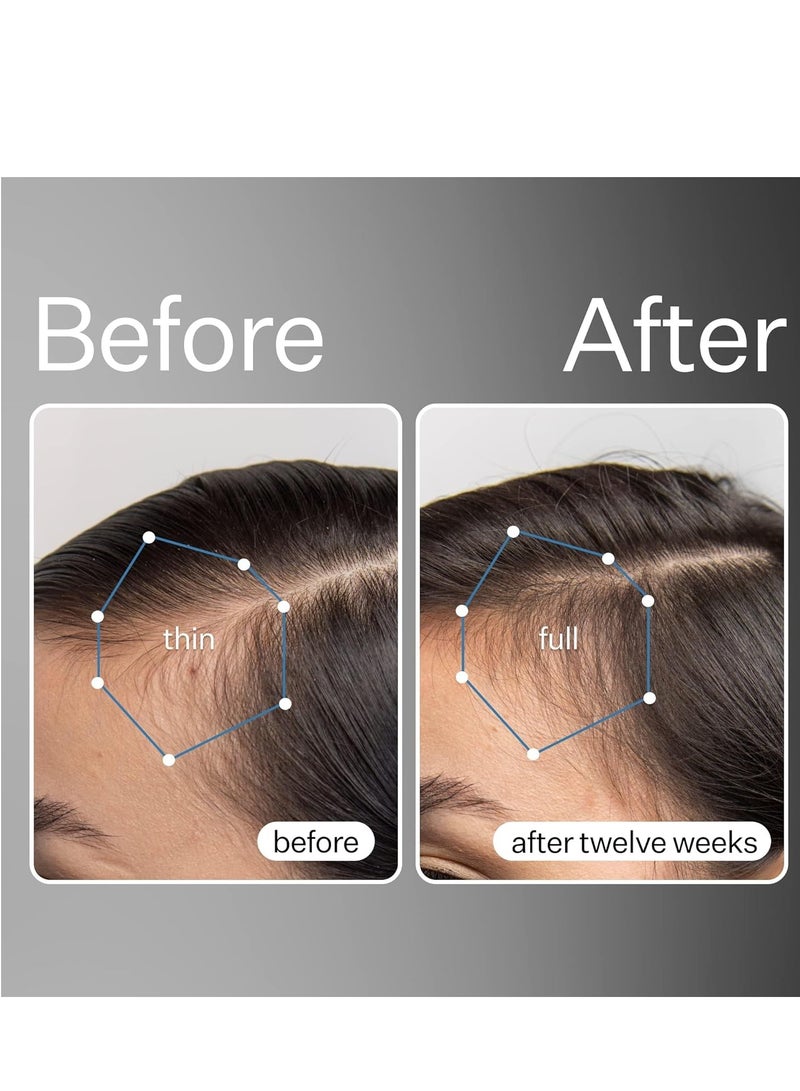 Act+Acre ACT+ ACRE Cold Processed Stem Cell Scalp Serum - Promotes Thicker and Fuller-Looking Hair - Soothes and Hydrates the Scalp - Sulphate and Paraben Free - Aloe Vera for Improved Scalp Health - 1 fl oz. - Image 3