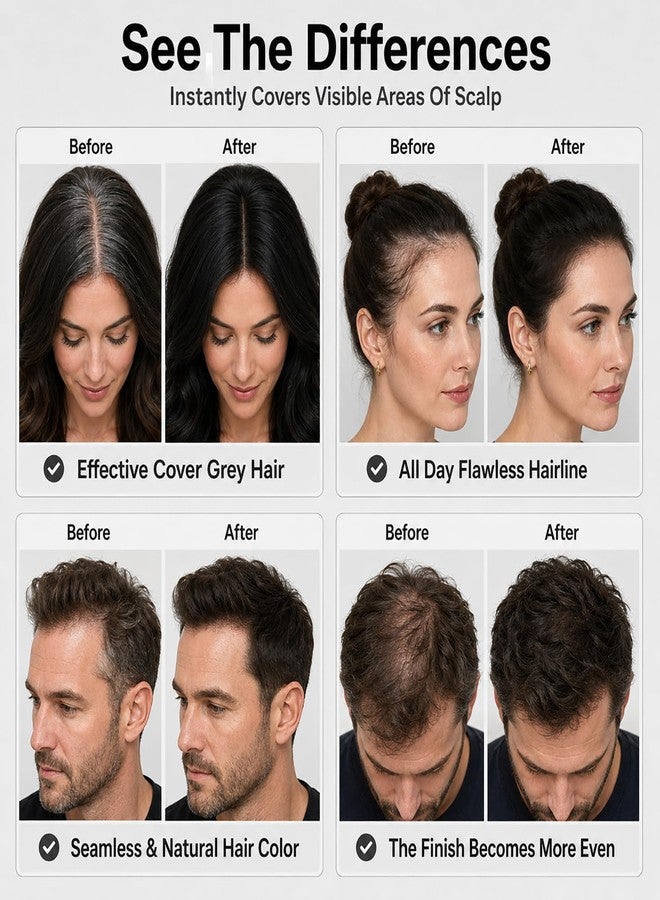 Gowwim Hair Fibers Dark Brown-Instant Thickening Powder for Thinning Hair - Image 2