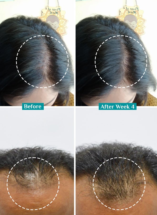 PILGRIM Redensyl Hair growth serum- 100 ml - Image 5