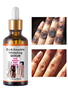 MOOYAM Dark Knuckle Whitening Serum - Skin Whitening Oil Brightening Dark Spots,Elbow Armpit Whitening Skin Whitening Knee Melanin,50ML  - Image 1