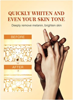 MOOYAM Dark Knuckle Whitening Serum - Skin Whitening Oil Brightening Dark Spots,Elbow Armpit Whitening Skin Whitening Knee Melanin,50ML  - Image 5