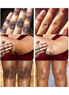 MOOYAM Dark Knuckle Whitening Serum - Skin Whitening Oil Brightening Dark Spots,Elbow Armpit Whitening Skin Whitening Knee Melanin,50ML  - Image 2