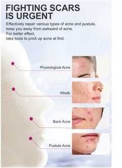 RtopR Fade Acne MarksSmooth Skin  - Image 3