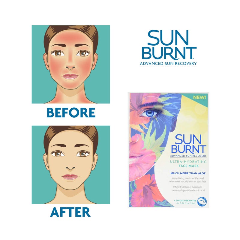 Sunburnt Ultra-Hydrating Face Sheet Mask, Advanced Sun Recovery, Treat Dry Sun Damaged Skin, For After Sun Exposure, Much More than Aloe, Soothes and Rehydrates Hot Dry Skin (4 single use masks) - Image 2