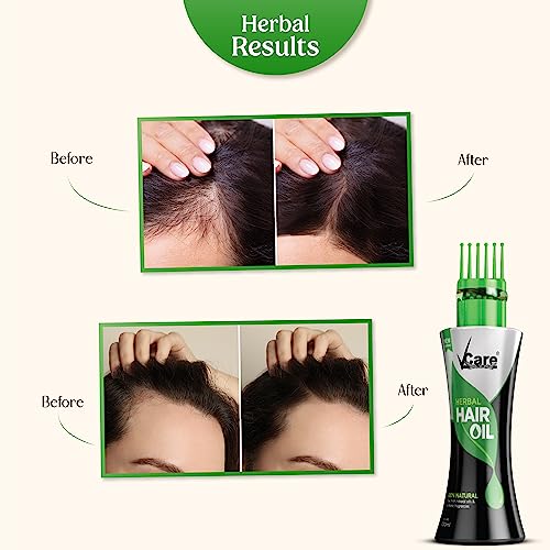 Vcare New Improved Herbal Hair Oil with Wonder Cap - 100ml - Image 4