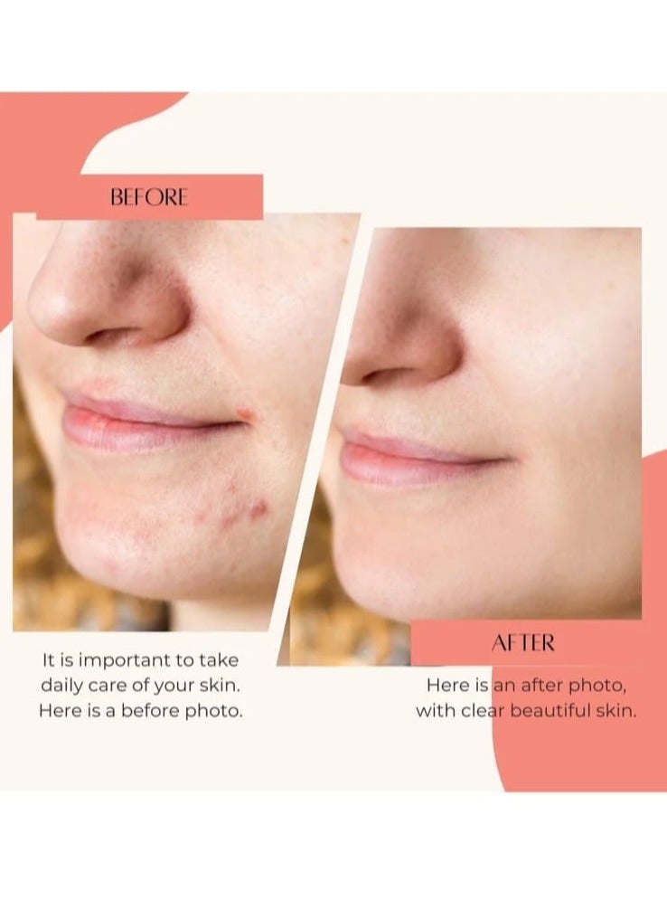 OGAILI Aker Fassi Face Mask Powder – Moroccan Skincare Secret for Glowing Skin – Natural Herbal Cleanser with Anti-Aging Benefits & Skin Tone Enhancement – 100g, Chemical-Free & Cruelty-Free - Image 2