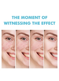 MOOYAM Salicylic Acid Salvia Miltiorrhiza Remove Acne Gel Lighten Acne Marks Remove Acne and Shrink Pores Plant Essence-Fast Acne Removal in 12 Hours to See Results  - Image 5