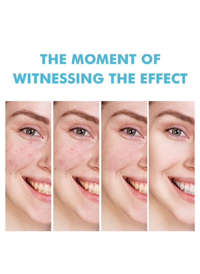 MOOYAM Salicylic Acid Salvia Miltiorrhiza Remove Acne Gel Lighten Acne Marks Remove Acne and Shrink Pores Plant Essence-Fast Acne Removal in 12 Hours to See Results  - Image 5