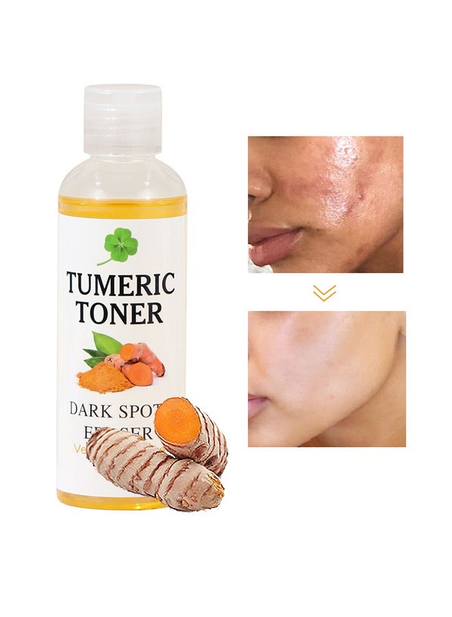 MOOYAM Turmeric Dark Spot Corrector Toner 100ML Facial Toner For Acne Prone Skin Dark Spot Remover For Face Hydrating Face Toner For Women Treatment 100ml  - Image 1