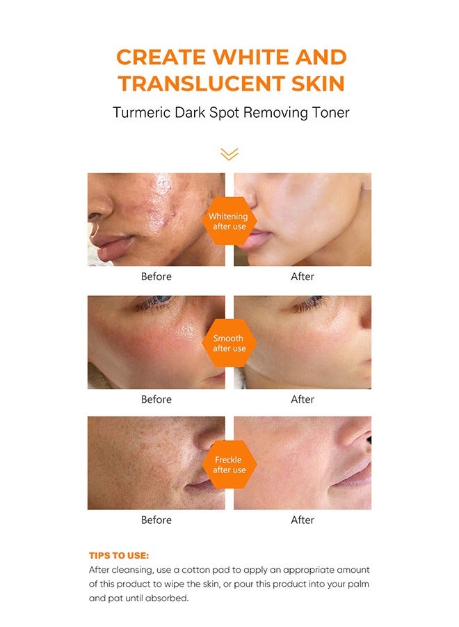 MOOYAM Turmeric Dark Spot Corrector Toner 100ML Facial Toner For Acne Prone Skin Dark Spot Remover For Face Hydrating Face Toner For Women Treatment 100ml  - Image 4