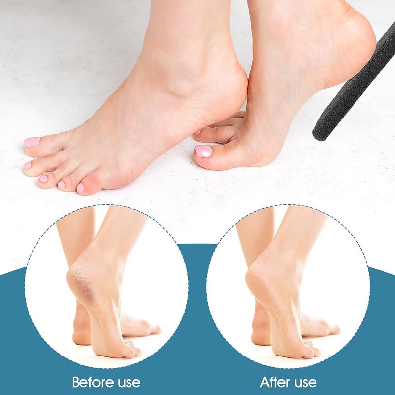 WLLHYF Foot File, Pumice Stone Exfoliating Pedicure Rasp Foot Scrubber with Wooden Handle, Remove Hard Dead Skin Callus Dry Rough Cracked Corn Feet in Shower, Black - Image 4