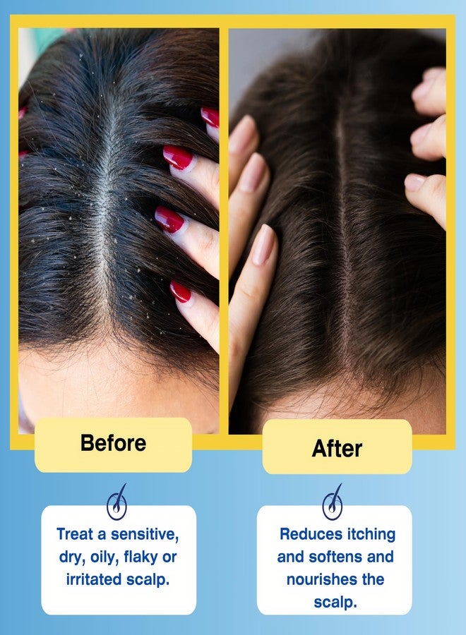 Mediceuticals Therapro Therapeutic Scalp Rinse 33.8 Fl Oz - Image 5