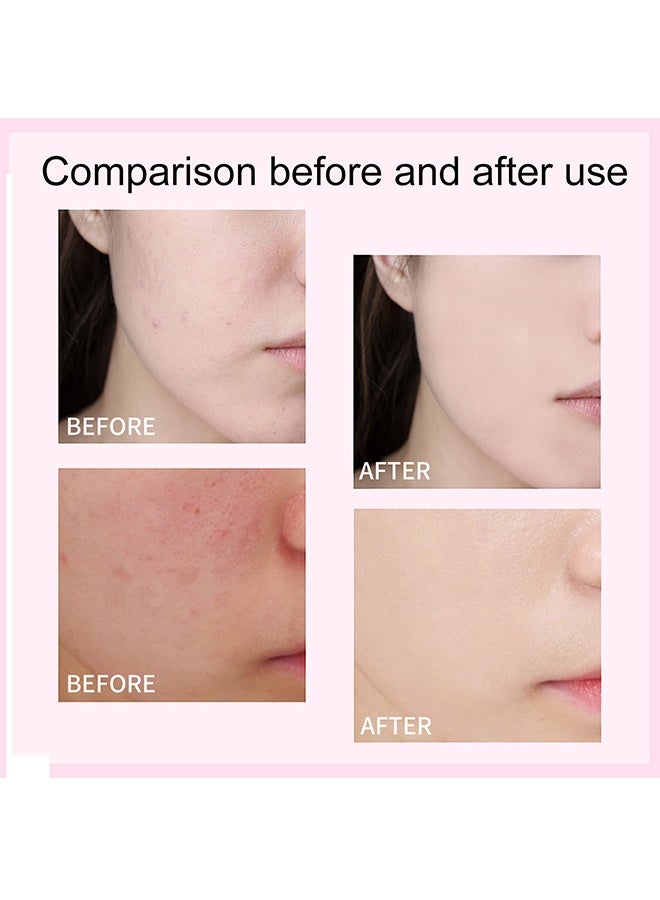 إيلهو كريم تصحيح اللون CC بتغطية كاملة SPF 50، كريم أساس CC، سيروم خفيف مرطب مع تغطية كاملة، يتحكم في الدهون ويرطب البشرة، كريم تصحيح اللون مطفي طويل الأمد (فاتح) 30 مل - Image 5