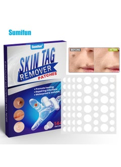 Skin Tag Remover Patches, Effective Acne Removal Patches, Fast Acting Safe Spot Stickers for Moles Skin Tag Acne Scars Corn, Acne Patches for Face and Skin 144 Patches