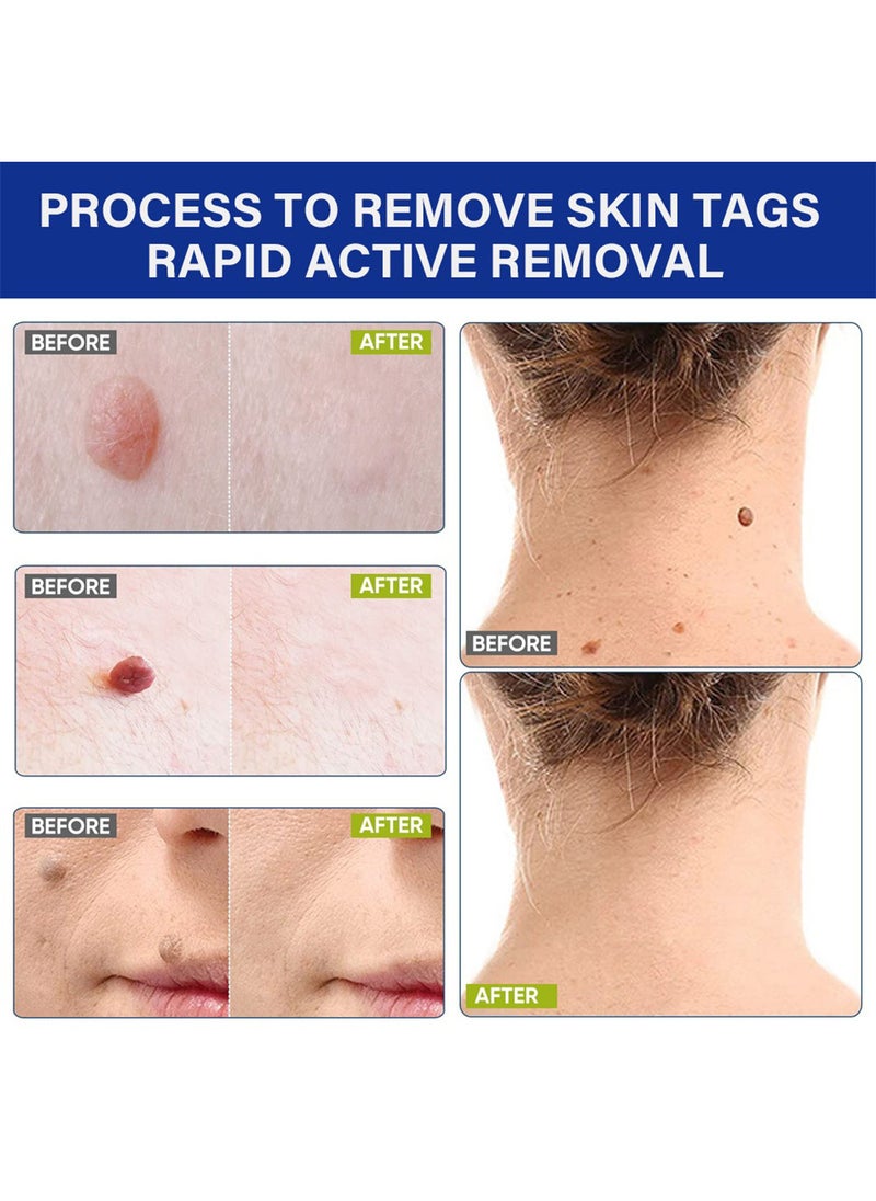 Sumifun Skin Tag Remover Patches, Effective Acne Removal Patches, Fast Acting Safe Spot Stickers for Moles Skin Tag Acne Scars Corn, Acne Patches for Face and Skin 144 Patches  - Image 4