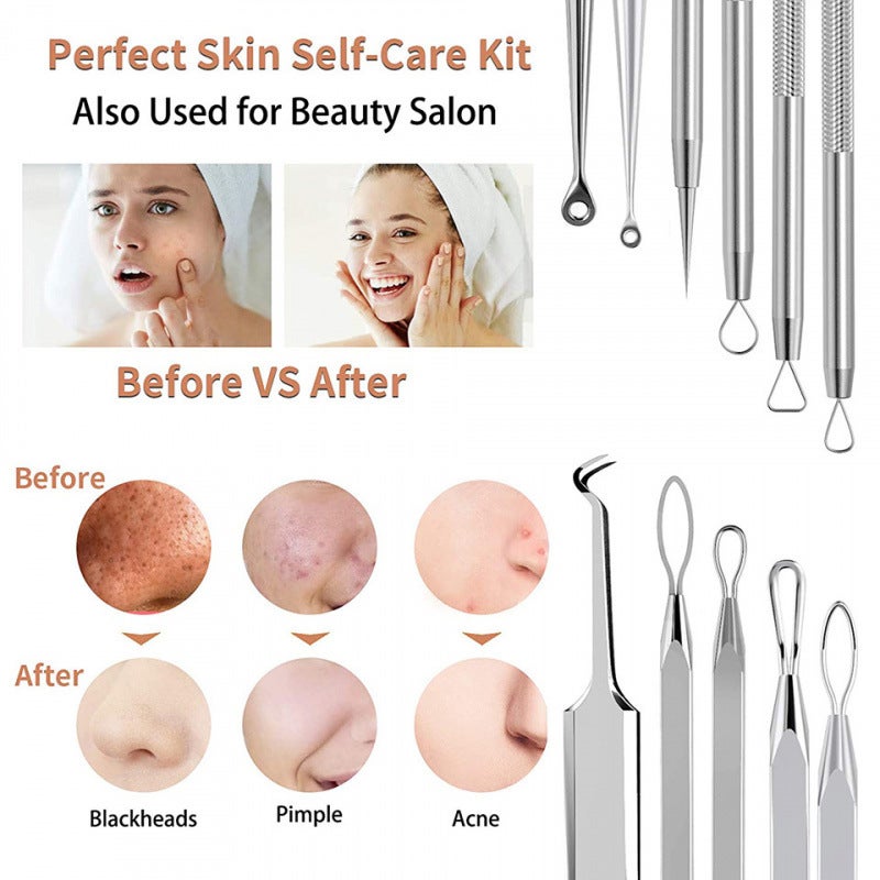 Acne Blackhead Remover Tool Kit 6-Piece Set - Image 5