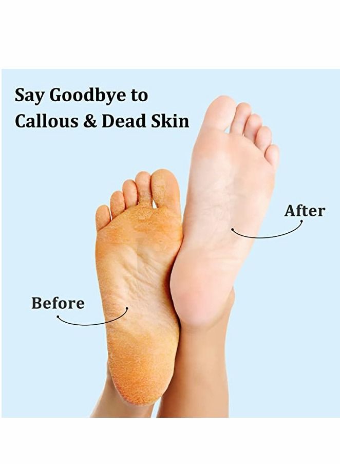 SYOSI 50 PCS Pedicure Sandpapers Replacement Pad, Foot Files Reusable Foot File Callus Remover Professional Abrasive Feet Rasp Foot Refill Pads for Hard Skin, Foot Exfoliate (Foot File Not Included) - Image 2