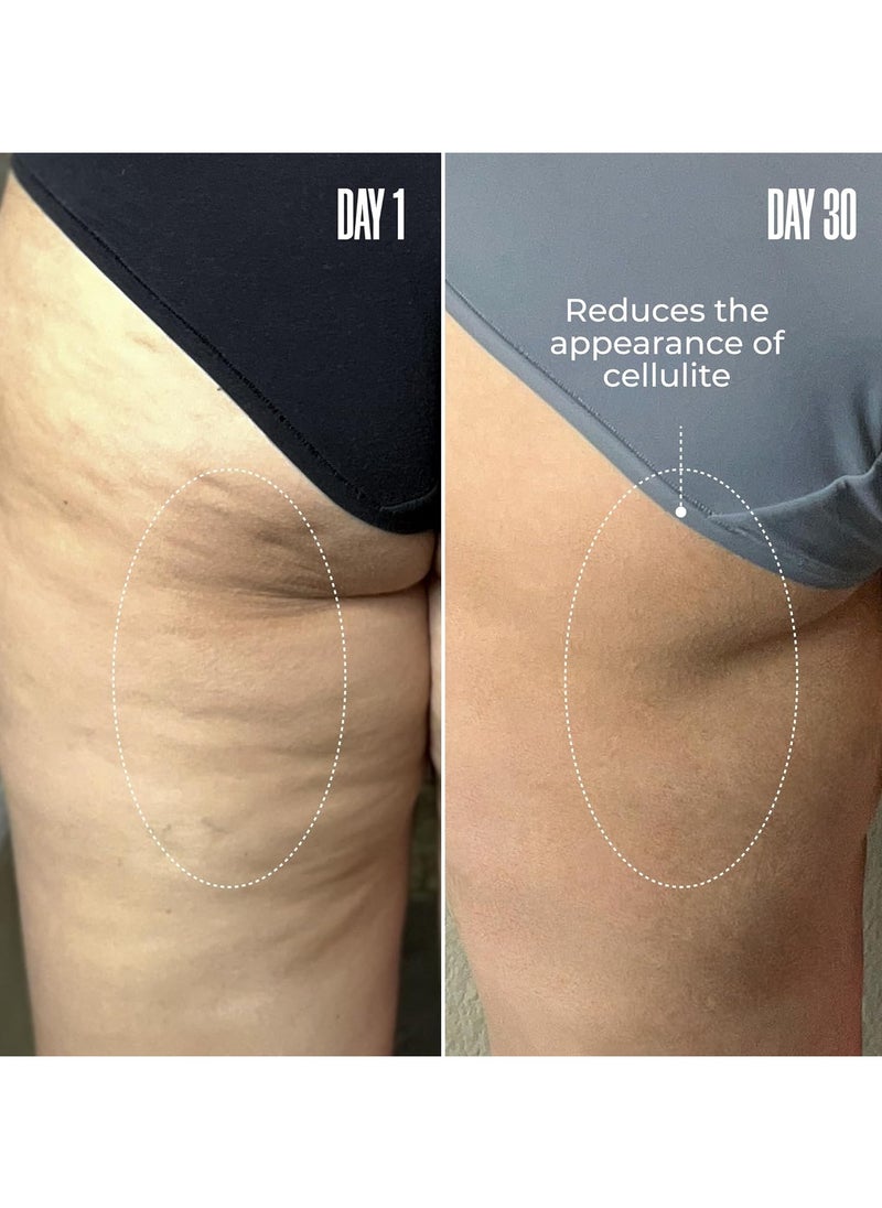 Maelys Cosmetics B-TIGHT Leave-On Cellulite Mask - Reduces The Appearance Of Cellulite - Visibly Tightens The Skin In The Butt Area  - Image 3