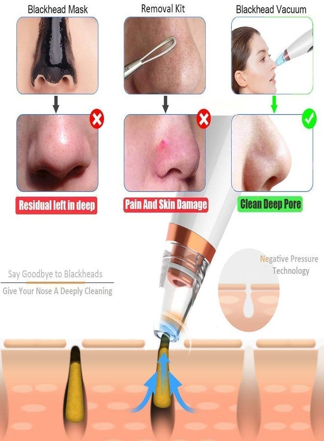 PIPALIYA Multifunctional Blackhead Whitehead Extractor Remover Acne, Pimple, Pore Cleaner Vacuum Suction Tool For Men And Women (MULTI COLOUR) - Image 4