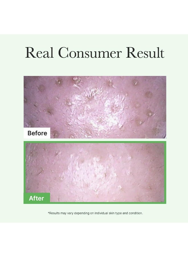 ARENCIA Pore Melt Mochi Makeup-Removing Cleansing Oil, Non-Comedogenic, Rice Amino Acids HD, Vitamin E, Cica, & Ceramide | 200ml - Image 4