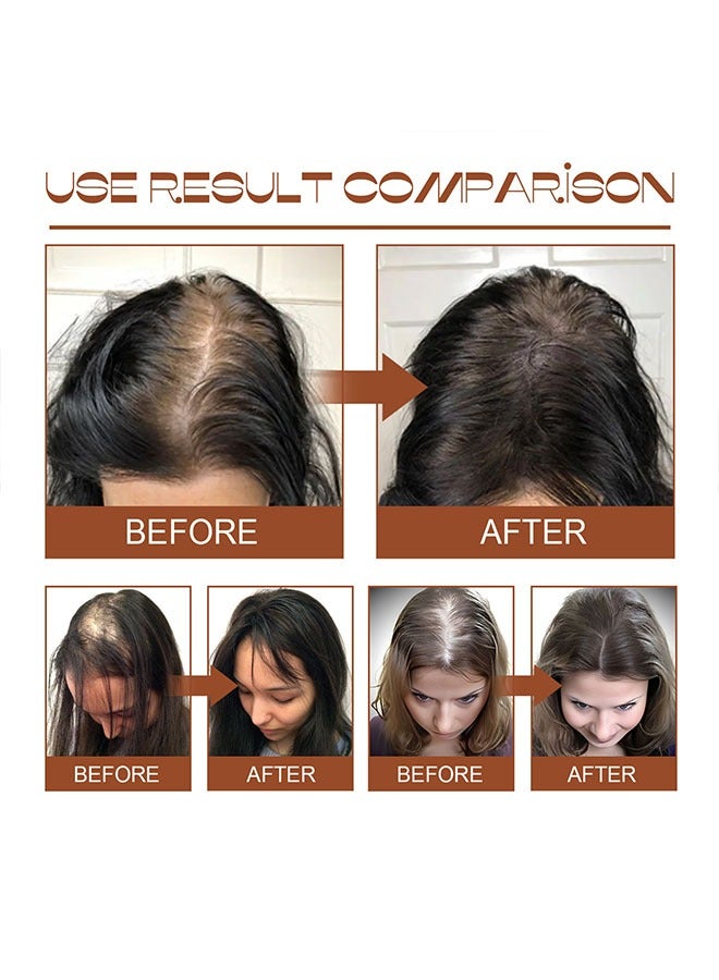 EELHOE Batana Oil 120ml, Batana Oil Conditioner for Thicker, Fuller and Healthier Hair, Revitalized Hair Growth and Strength, Nourishing Hair Moisturizer for Damaged Hair Repair, Batana Oil Hair Mask - Image 4