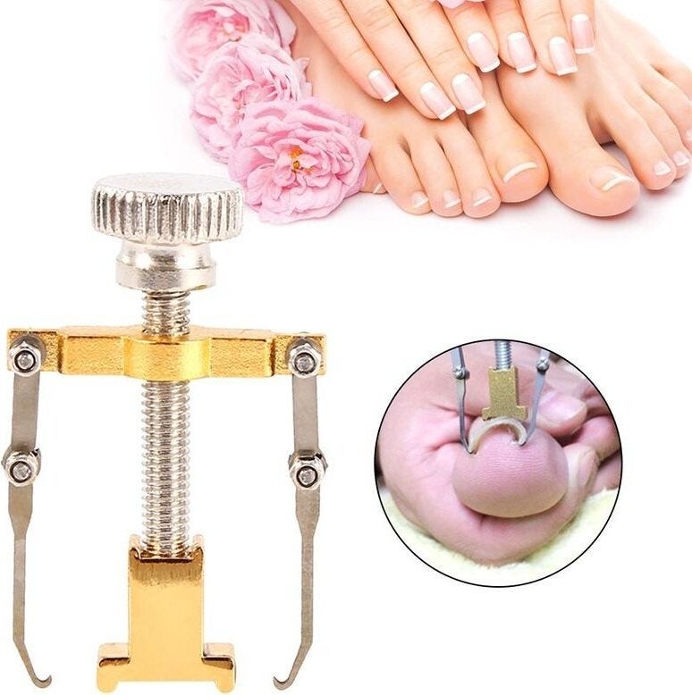 nail مزيل الشعر الغائر 