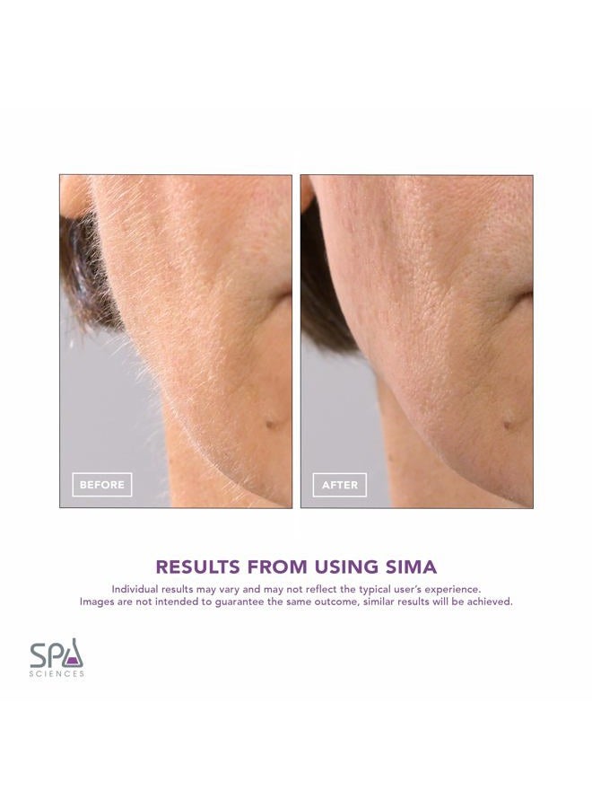 Spa Sciences SIMA Patented Sonic Dermaplaning Tool-Professional & Painless 2-N-1 Facial Exfoliation & Peach Fuzz-Hair Removal System w/ 7 Weeks Treatment Included|Anti-Aging|3 Speeds |Rechargeable - Image 5