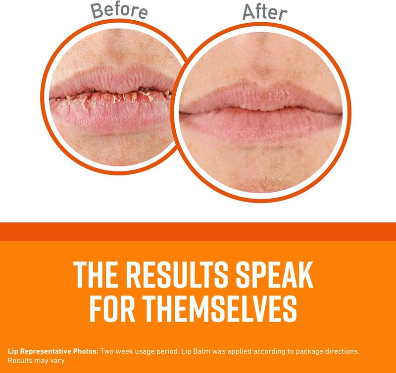 Unscented Lip Repair Lip Balm for Dry, Cracked Lips, Stick, (Pack of 2), clear (K0700137) - Image 2