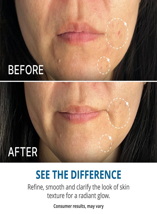 goPure Refine It 2% BHA Liquid Exfoliant - Pore refining, texture smoothing, complexion correcting, infused with nourishing fruit extracts, safe for all skin types - Image 3