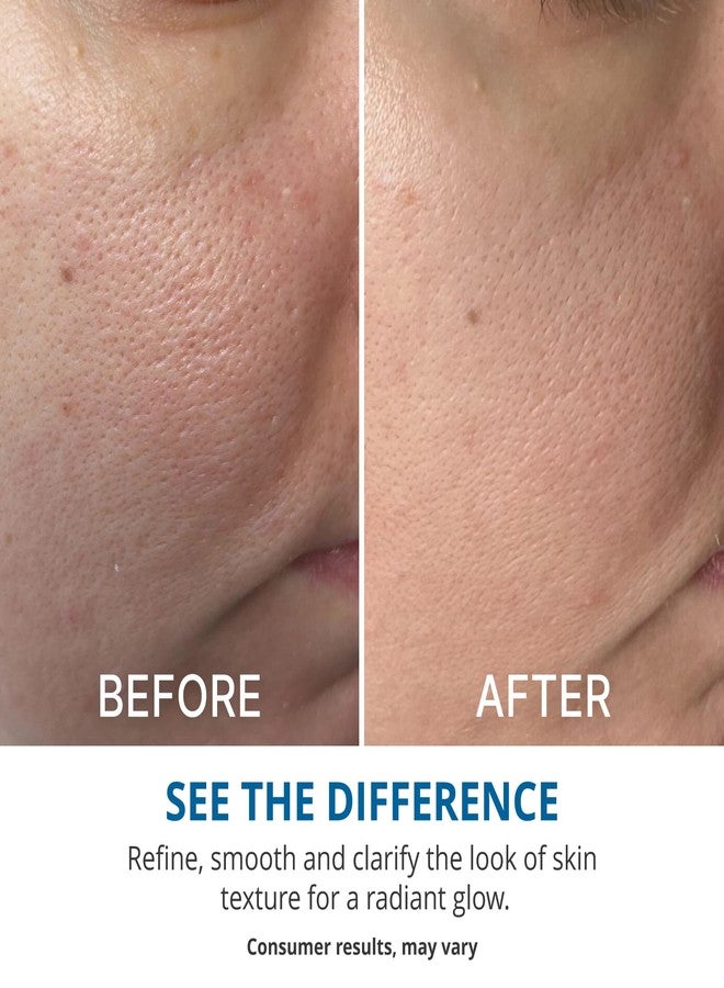 goPure Refine It 2% BHA Liquid Exfoliant - Pore refining, texture smoothing, complexion correcting, infused with nourishing fruit extracts, safe for all skin types - Image 5